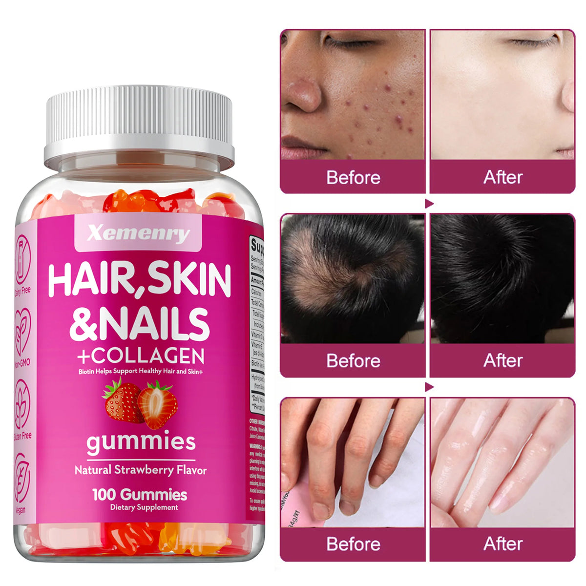 Biotin Hair Skin And Nail Gummies – Vitamin Supplement
